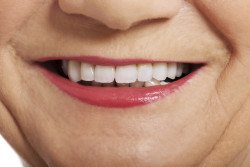 Close up on ol woman's smile, teeth.