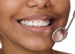 Teeth whitening, Newport News, VA