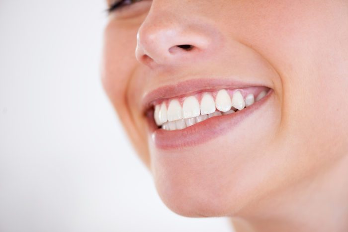 How to Treat Porous Teeth in Newport News, Virginia