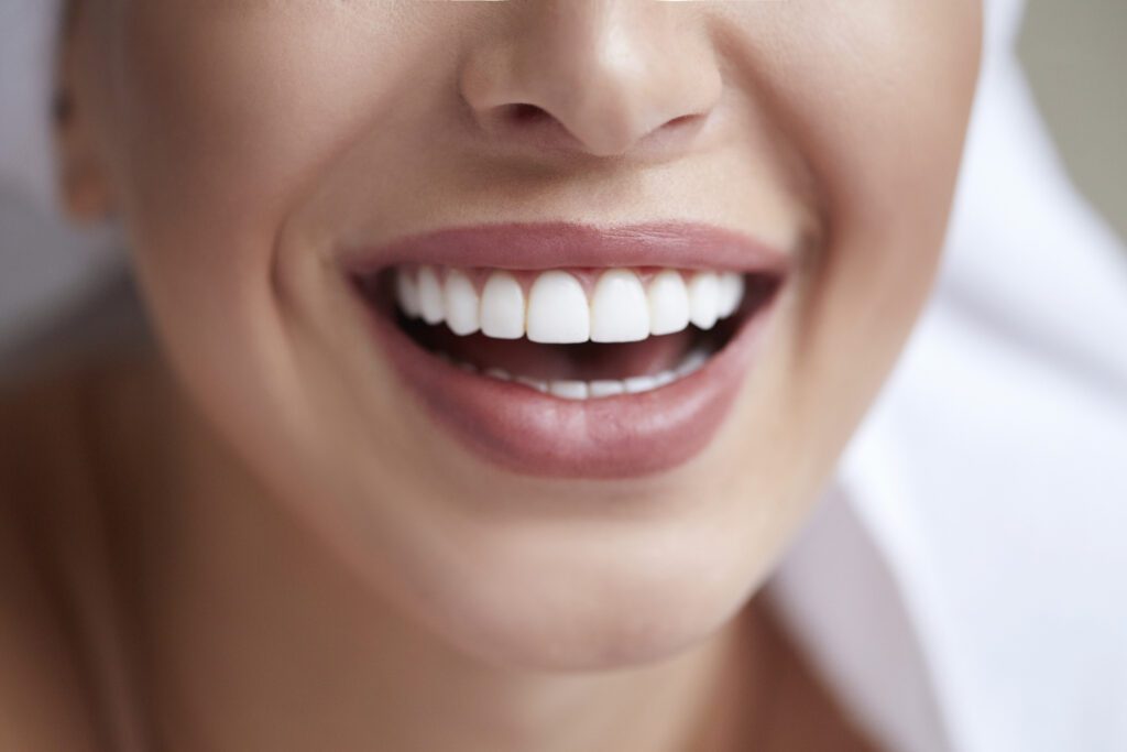 What to Know Before Getting Veneers | Newport News VA Dentist