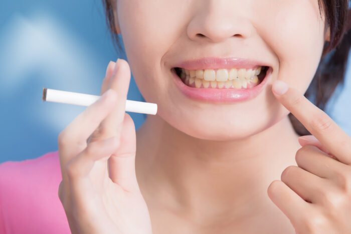 How Smoking Impacts Dental Implants