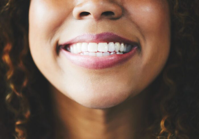Both options offer solutions for improving the appearance of teeth, but porcelain veneers provide distinct advantages.
