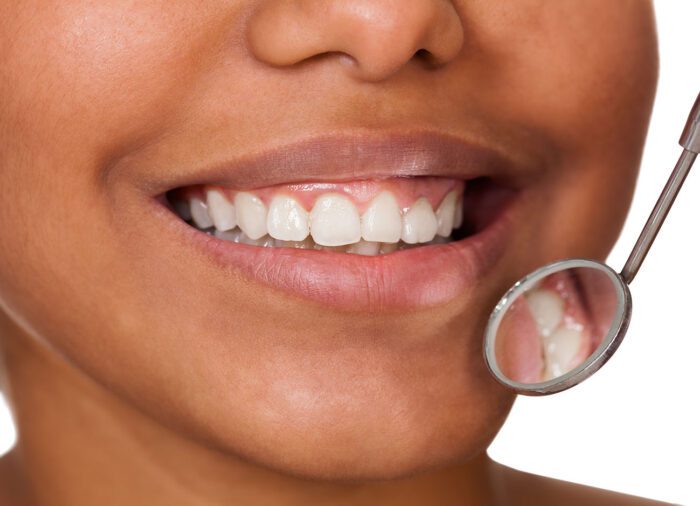 Recognizing the early signs of gum disease is crucial for effective treatment and maintenance of your oral health.